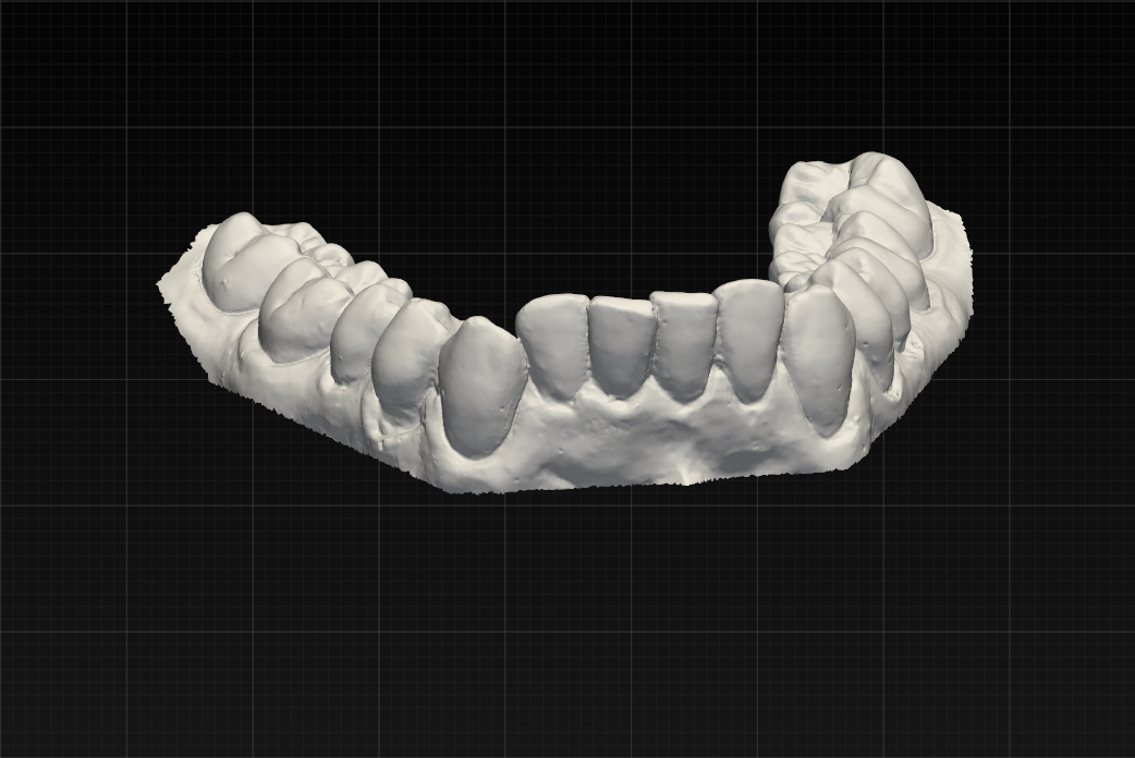 3D-Scan vorher